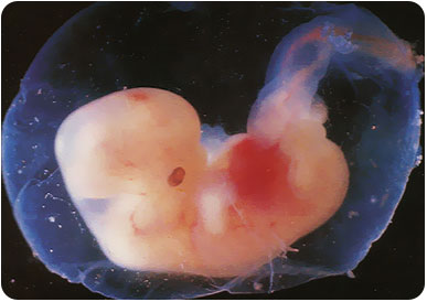 Эмбрион человека (седьмая неделя)