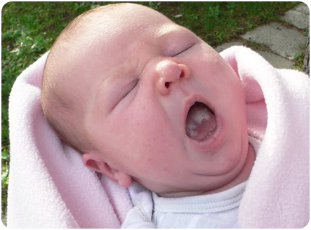 Молочница у маленького ребенка на слизистой ротовой полости