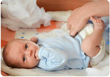 Новорожденному малышу меняют памперс