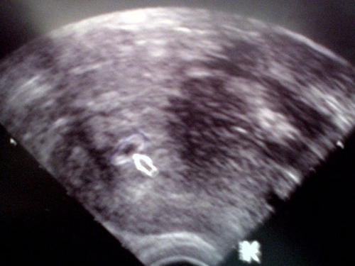 Как выглядит эмбрион 3 недели фото