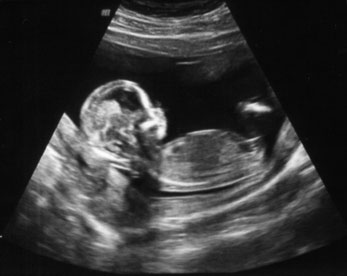Малыш на 12 недели беременности