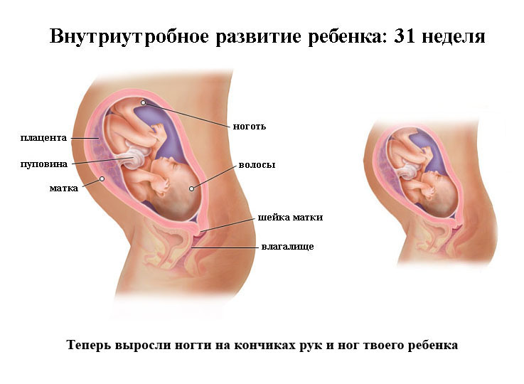 Внутриутробное развитие ребенка на 31 неделе беременности