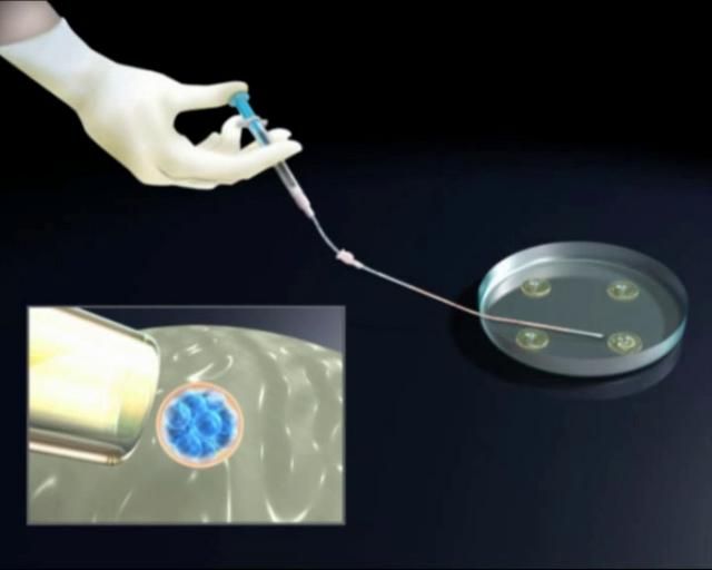 Инструмент для подсадки эмбриона
