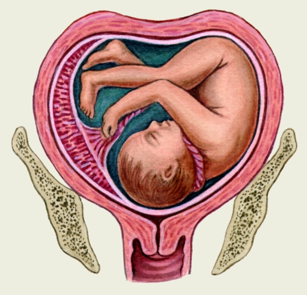 Влияние седловидной матки на зачатие