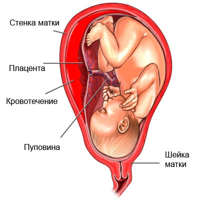 Плацента на поздних сроках беременности