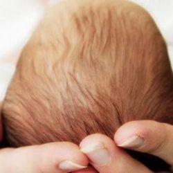 Большой родничок у новорожденного: когда зарастает, нормы, патология Большой родничок у новорожденного: когда зарастает, нормы, патология