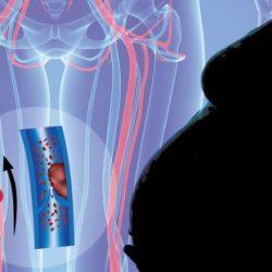 Д-димер при беременности: норма по неделям Д-димер при беременности: норма по неделям