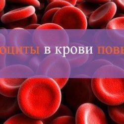 Эритроциты в крови повышены