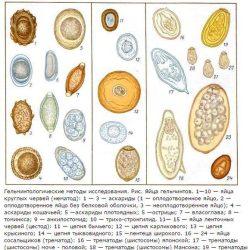 Анализ кала на яйца глист Анализ кала на яйца глист