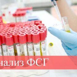 Анализ ФСГ Анализ ФСГ