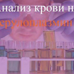 Анализ крови на церулоплазмин Анализ крови на церулоплазмин