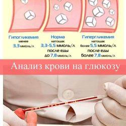 Анализ крови на глюкозу Анализ крови на глюкозу