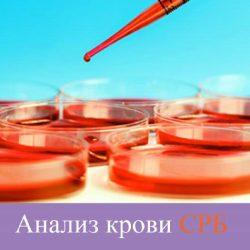 Анализ крови СРБ