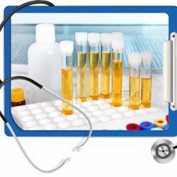 Анализ мочи по Зимницкому Анализ мочи по Зимницкому