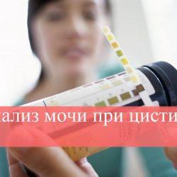 Анализ мочи при цистите Анализ мочи при цистите