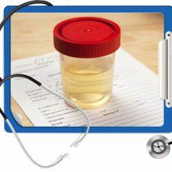 Анализ мочи расшифровка Анализ мочи расшифровка