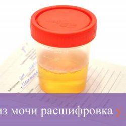 Анализ мочи расшифровка у детей норма в таблице Анализ мочи расшифровка у детей норма в таблице