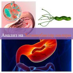 Анализ на Хеликобактер пилори Анализ на Хеликобактер пилори