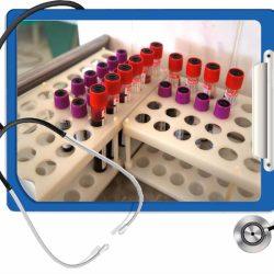 АСТ в крови что это такое? АСТ в крови что это такое?