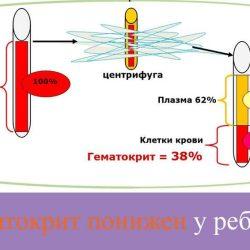 Гематокрит понижен у ребенка