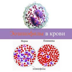 Эозинофилы в крови Эозинофилы в крови