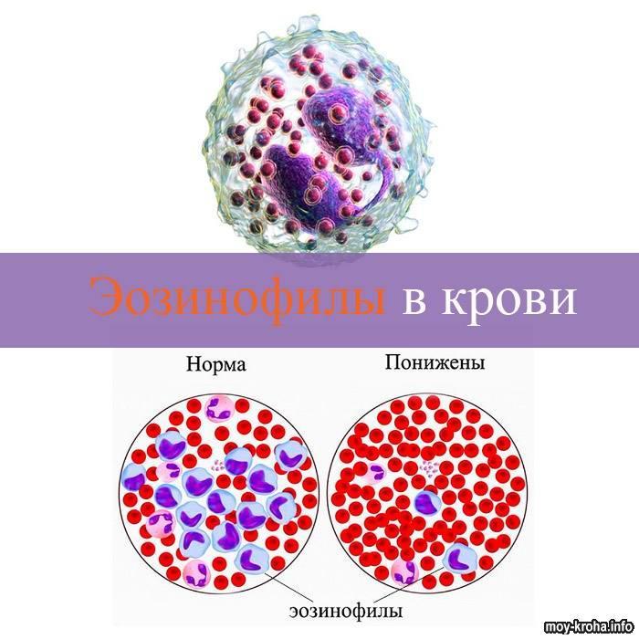 Эозинофилы в крови