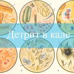 Детрит в копрограмме Детрит в копрограмме
