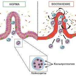 Кальпротектин Кальпротектин