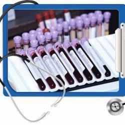 Креатинин в крови повышен причины Креатинин в крови повышен причины