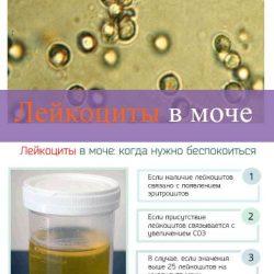 Лейкоциты в моче норма Лейкоциты в моче норма