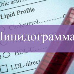 Липидограмма Липидограмма