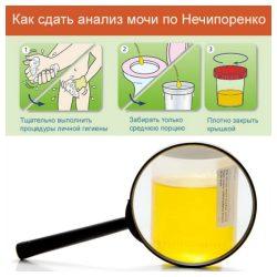 Анализ мочи по Нечипоренко как собирать Анализ мочи по Нечипоренко как собирать