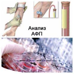 Анализ АФП Анализ АФП
