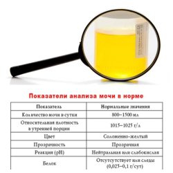 Общий анализ мочи Общий анализ мочи
