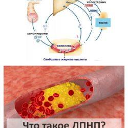 Анализ крови ЛПНП Анализ крови ЛПНП