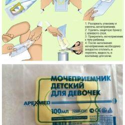 Как собрать мочу у девочки Как собрать мочу у девочки