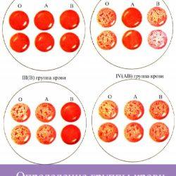 Определение группы крови с помощью цоликлонов Определение группы крови с помощью цоликлонов