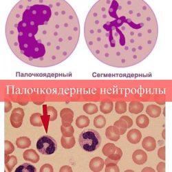 Палочкоядерные нейтрофилы Палочкоядерные нейтрофилы