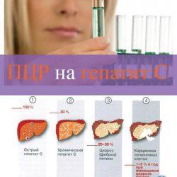 ПЦР на гепатит С ПЦР на гепатит С