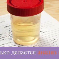 Сколько делается анализ мочи Сколько делается анализ мочи