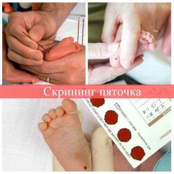 Скрининг пяточка Скрининг пяточка