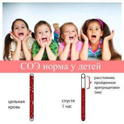 СОЭ норма у детей СОЭ норма у детей