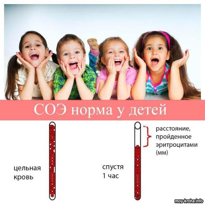 Соэ норма срб повышен