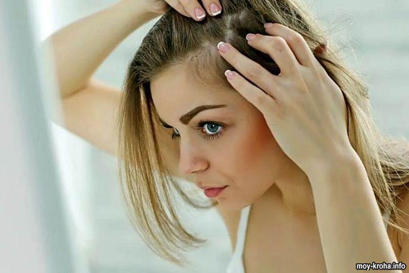 Три главных принципа в лечении псориаза кожи головы