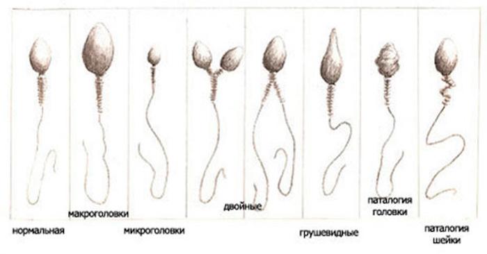 Спермограмма с морфологией по Крюгеру